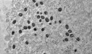 Descubra sintomas e tire dúvidas sobre a doença Mpox