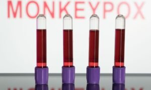 África declara emergência de saúde por epidemia de Mpox