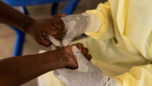 China impõe regras de monitoramento para evitar contaminação de Mpox.